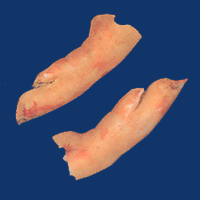 Frontfeet
