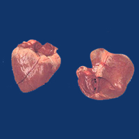 Hearts